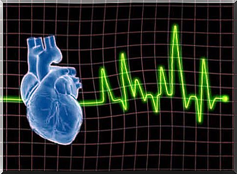 Stylized image of an electrocardiogram