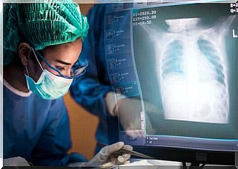 Everything you need to know about a lung transplant