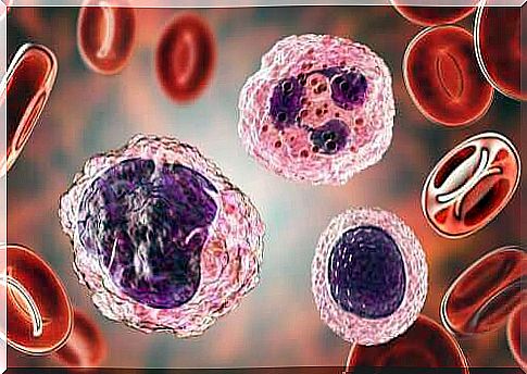 High Levels of Monocytes in the Blood: Symptoms and Treatments