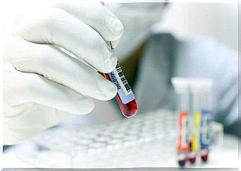 Lab examines blood test