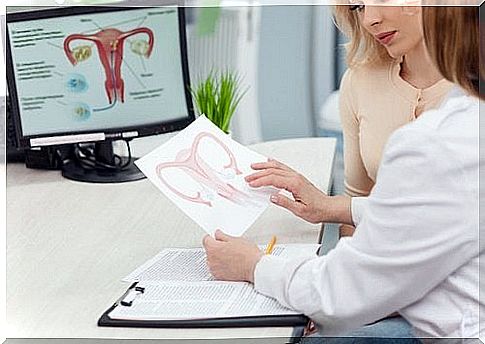 The detection of ovarian cancer by the doctor