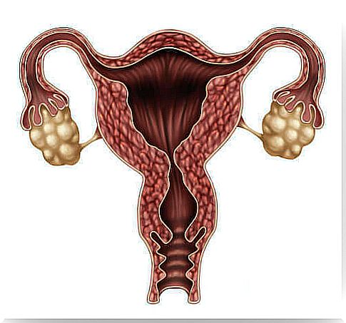 Drawing of ovaries and uterus