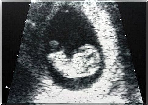 Photo of baby in womb