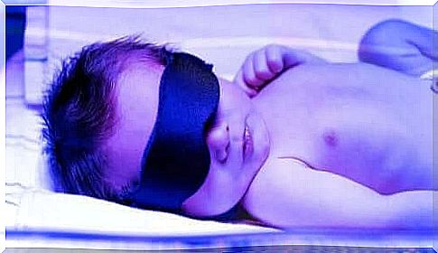 Jaundice in Newborns