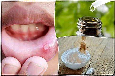 Relieve your mouth ulcers with these 6 natural treatments