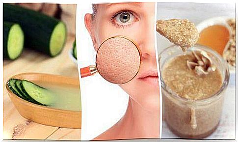 Tighten your pores with these 5 natural remedies