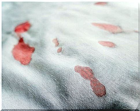 Bloodstains on a shirt