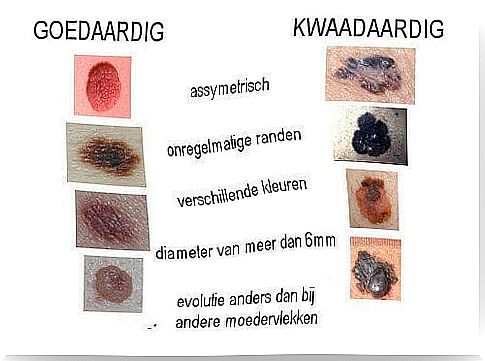 scheme with moles